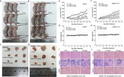 Wan-Nian-Qing, a Herbal Composite Prescription, Suppresses the Progression of Liver Cancer in Mice by Regulating Immune Response